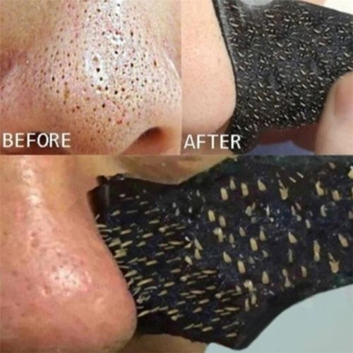 Nose Blackhead Remover Strips